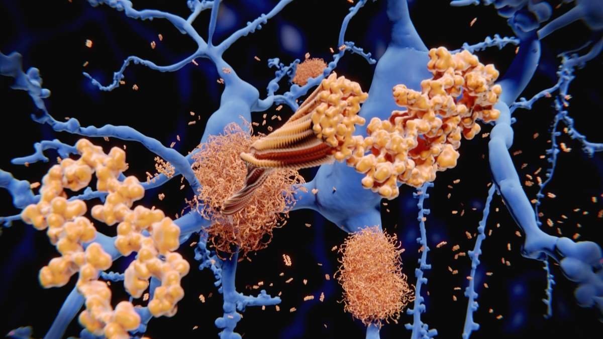 Meet FTL1: The Protein That's Been Aging Your Brain