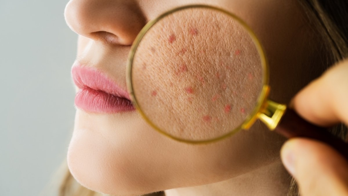 Your Skin Barrier Gets Destroyed