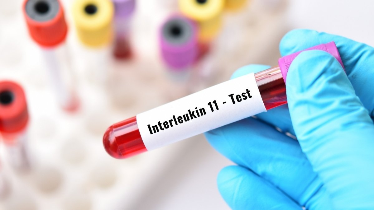 What Makes IL-11 the "Bad Guy" of Aging?