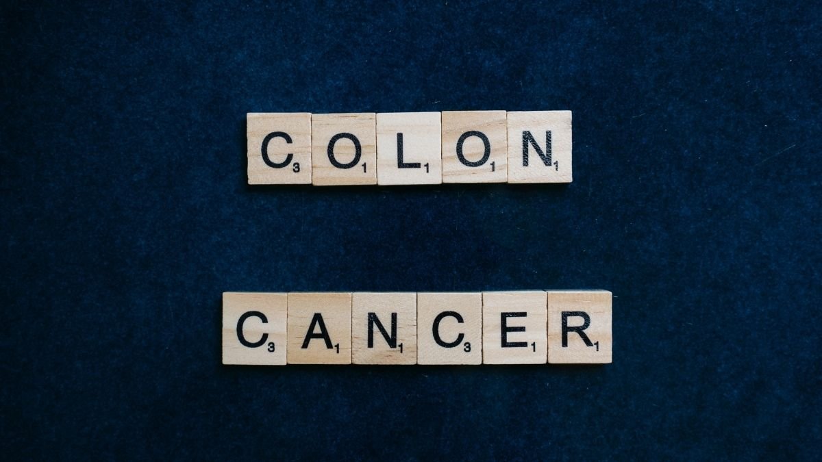 Colon Cancer