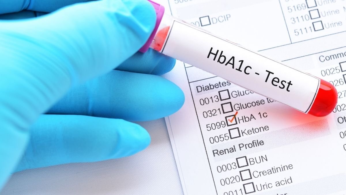 What's a "Normal" HbA1c, Really?