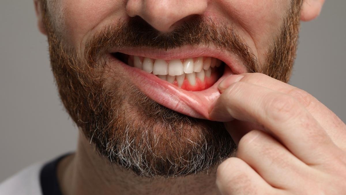 The Bacterial Breach: When Germs Go Rogue