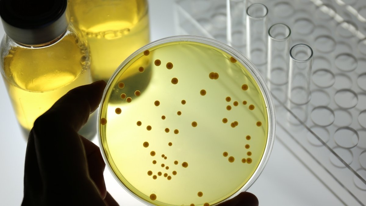 The Microbiological Penthouse You Can't Evict