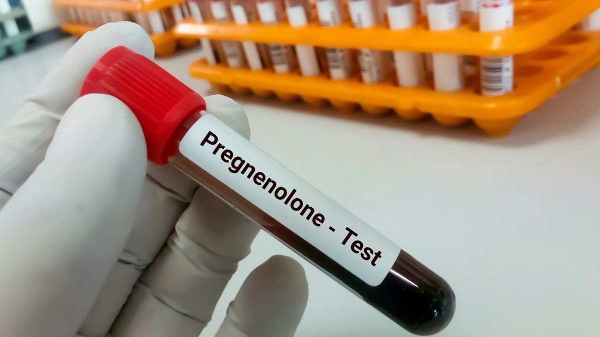 The "Pregnenolone Steal": How Cortisol Hijacks Your T-Factory