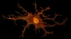 Alzheimer's Breakthrough: Two Hours of Sleep Restored Without Clearing Brain Plaques