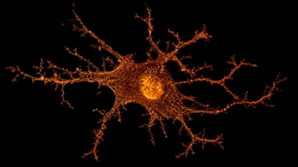 Alzheimer's Breakthrough: Two Hours of Sleep Restored Without Clearing Brain Plaques