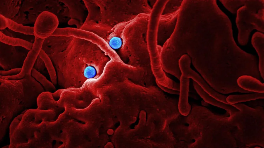 Microglia, Not Plaques, Are Stealing Sleep
