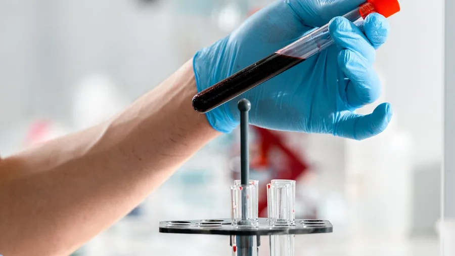 A Blood Marker Is Not a Window Into the Brain