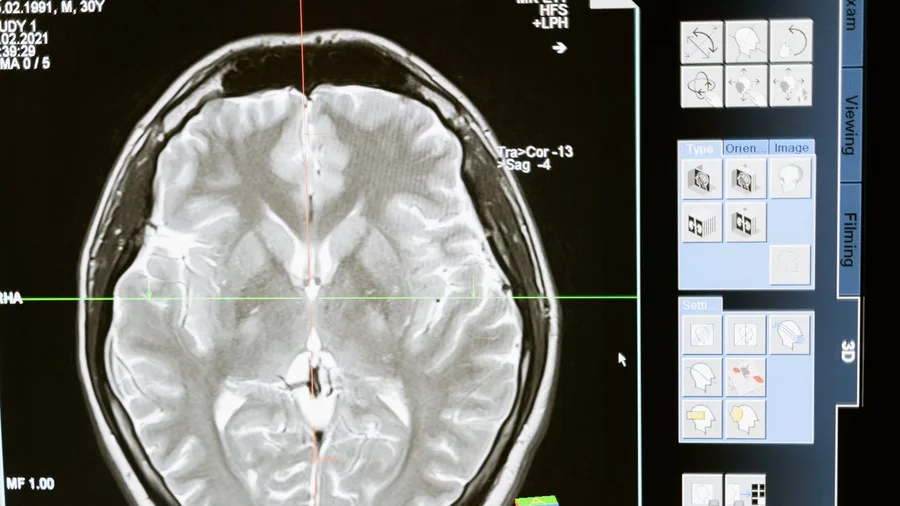 The Question Only Brain Imaging Can Answer