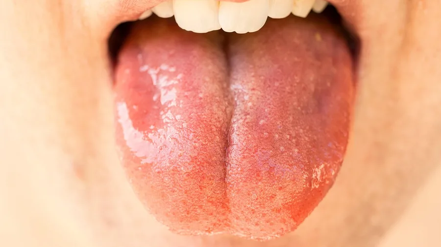 Sweet, Bitter, and Umami Go Quiet — Salt and Sour Often Survive