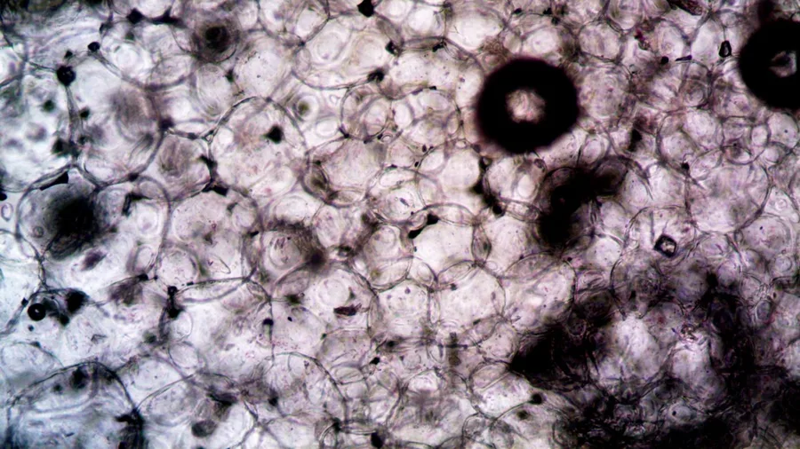 Cell Renewal Happens Every Few Weeks — So Why Has Taste Not Come Back?