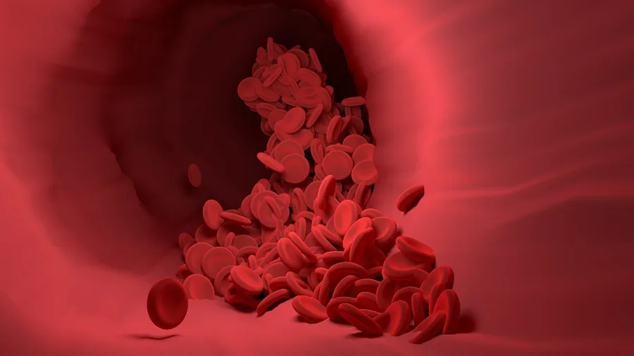 Excess Fibronectin Is the Damage Agent Around Brain Vessels