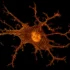 Probiotics May Guard Against Early Cognitive Decline, Trial Finds